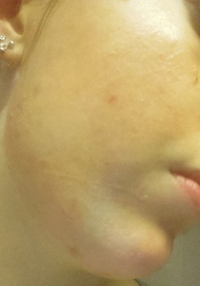 20160918_211728-420x600