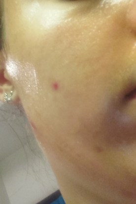 20161008_210438-533x800