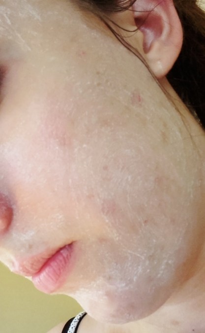 20170531_183419 (493x800)